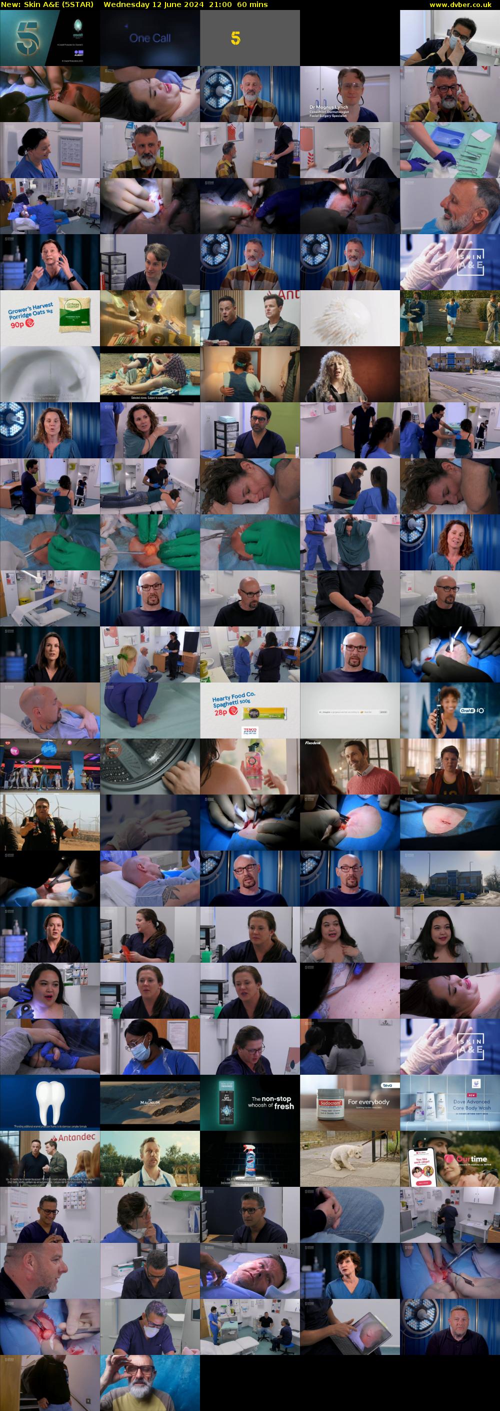 Skin A&E (5STAR) Wednesday 12 June 2024 21:00 - 22:00