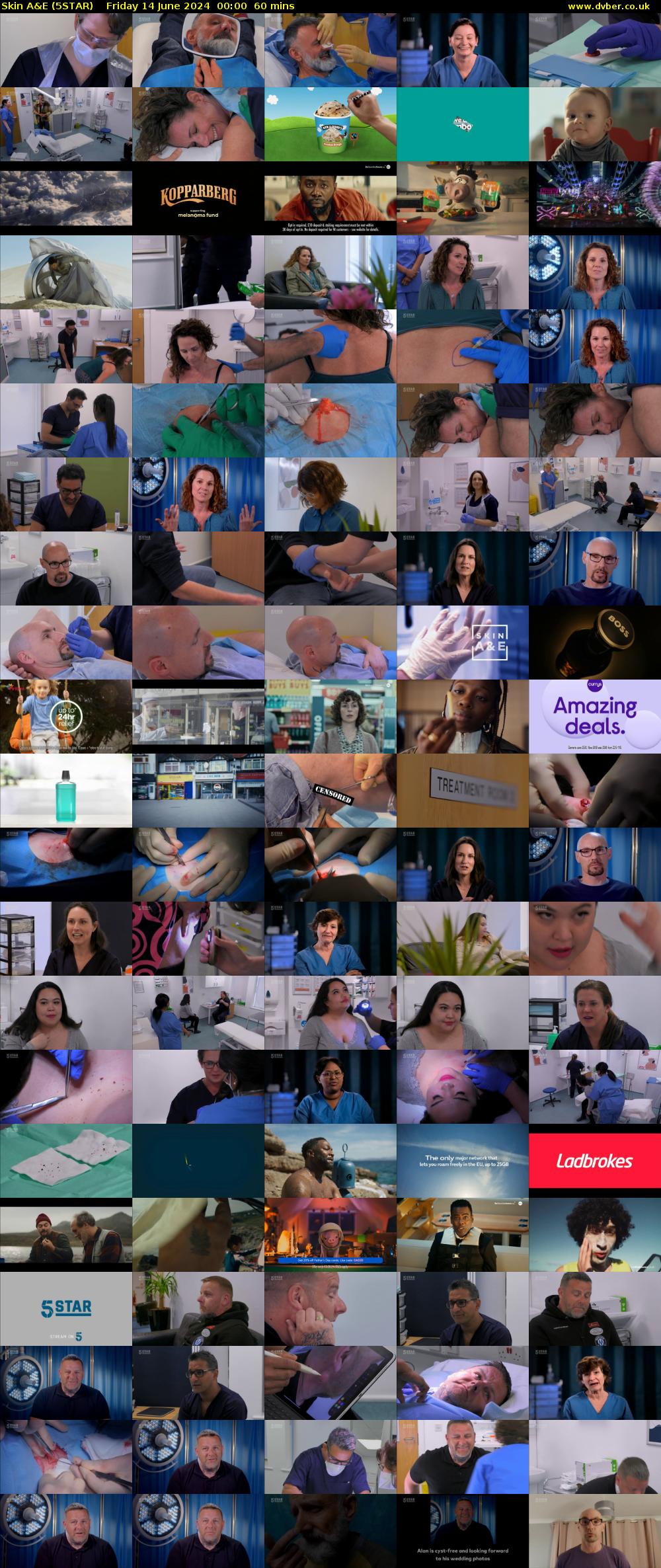 Skin A&E (5STAR) Friday 14 June 2024 00:00 - 01:00