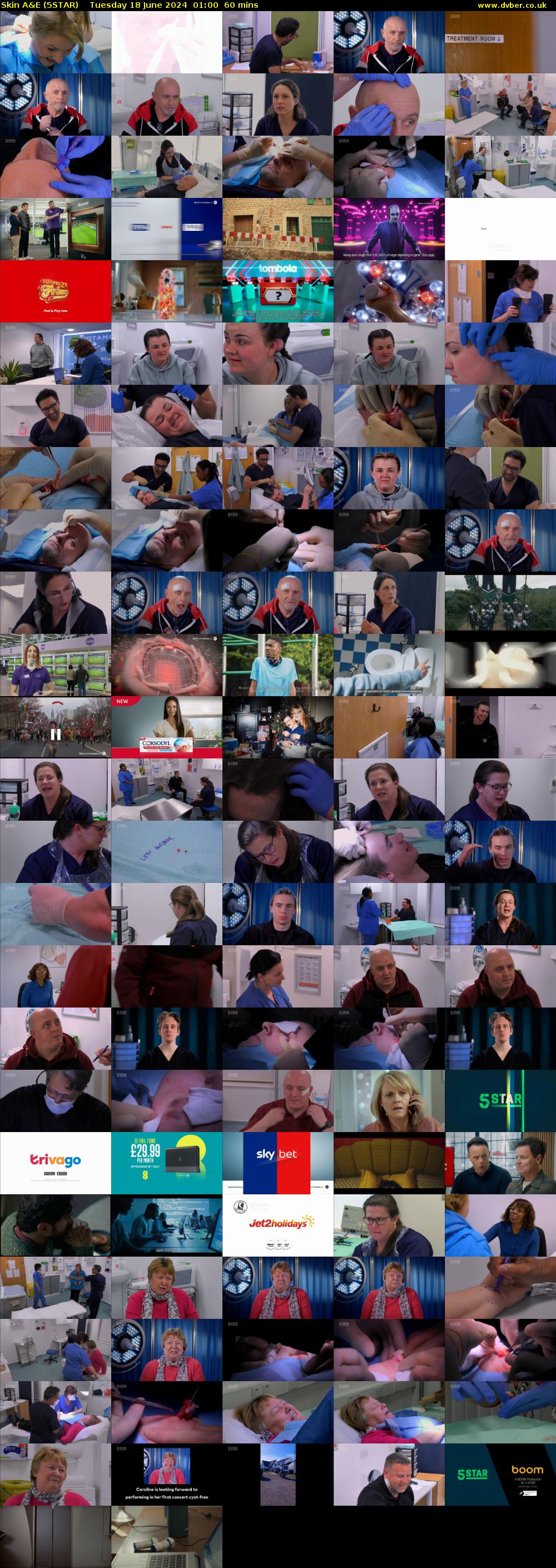 Skin A&E (5STAR) Tuesday 18 June 2024 01:00 - 02:00