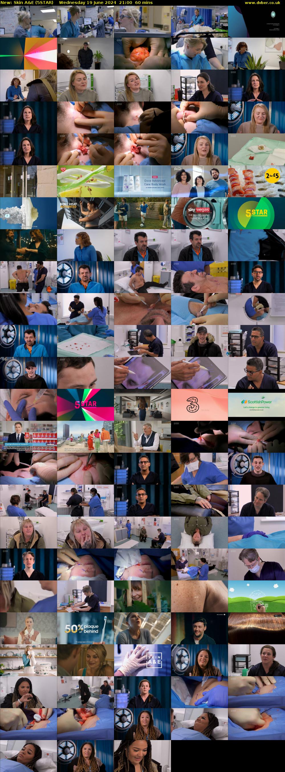 Skin A&E (5STAR) Wednesday 19 June 2024 21:00 - 22:00