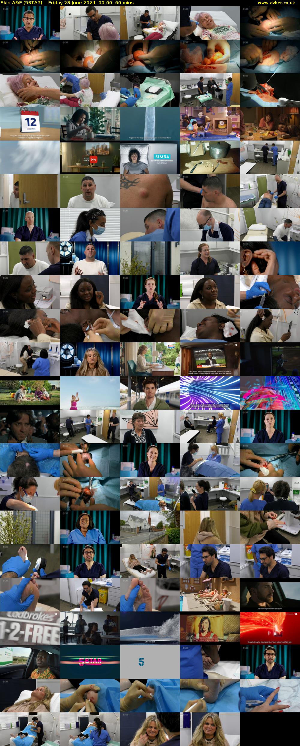 Skin A&E (5STAR) Friday 28 June 2024 00:00 - 01:00