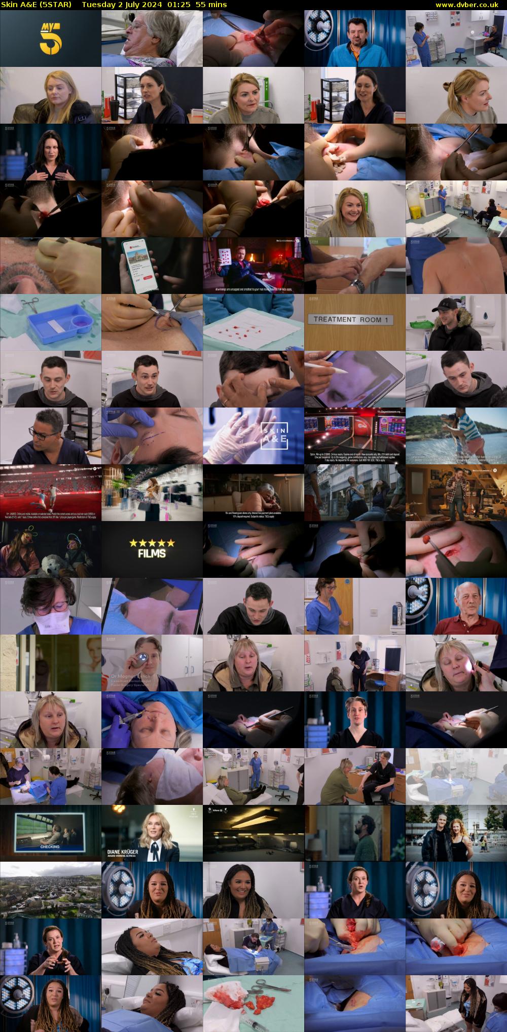 Skin A&E (5STAR) Tuesday 2 July 2024 01:25 - 02:20