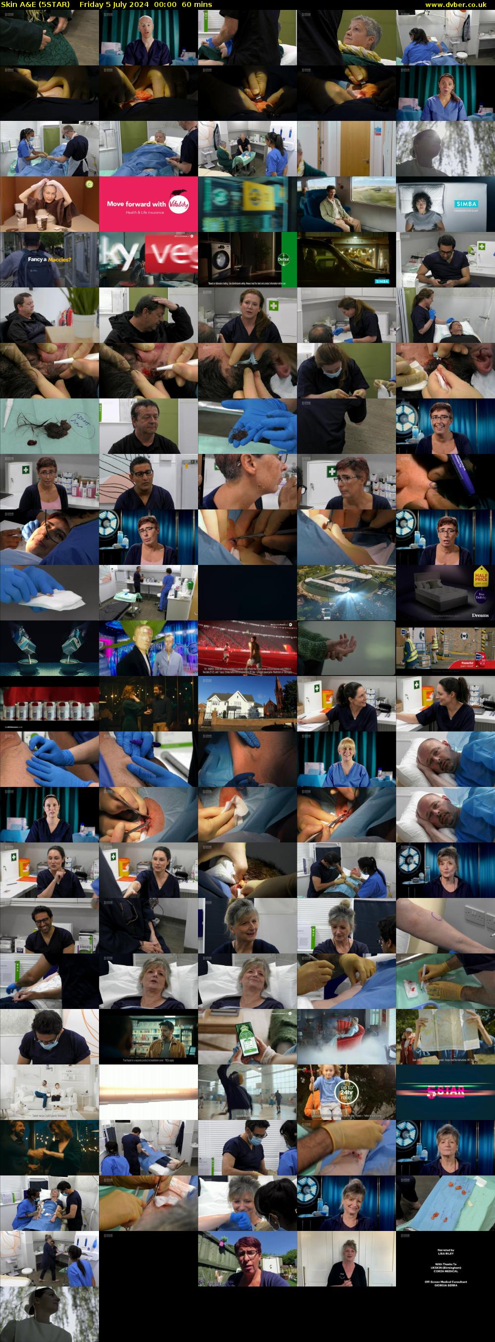 Skin A&E (5STAR) Friday 5 July 2024 00:00 - 01:00