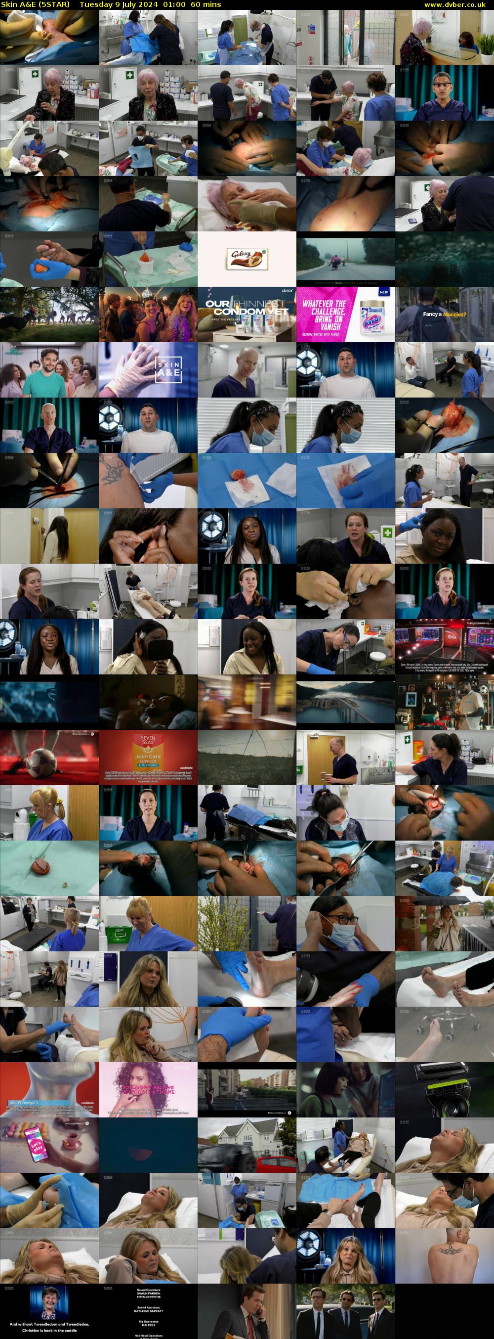 Skin A&E (5STAR) Tuesday 9 July 2024 01:00 - 02:00