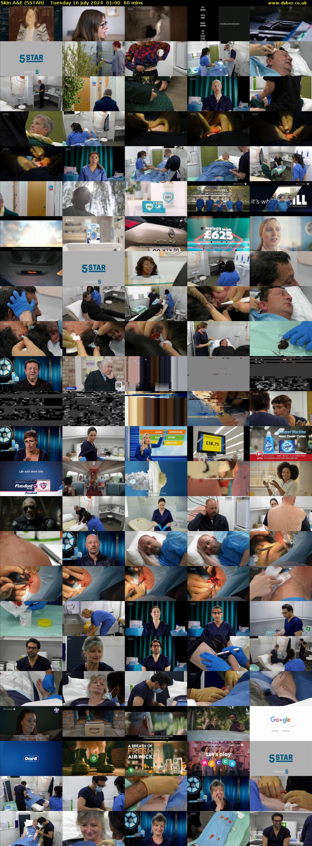 Skin A&E (5STAR) Tuesday 16 July 2024 01:00 - 02:00
