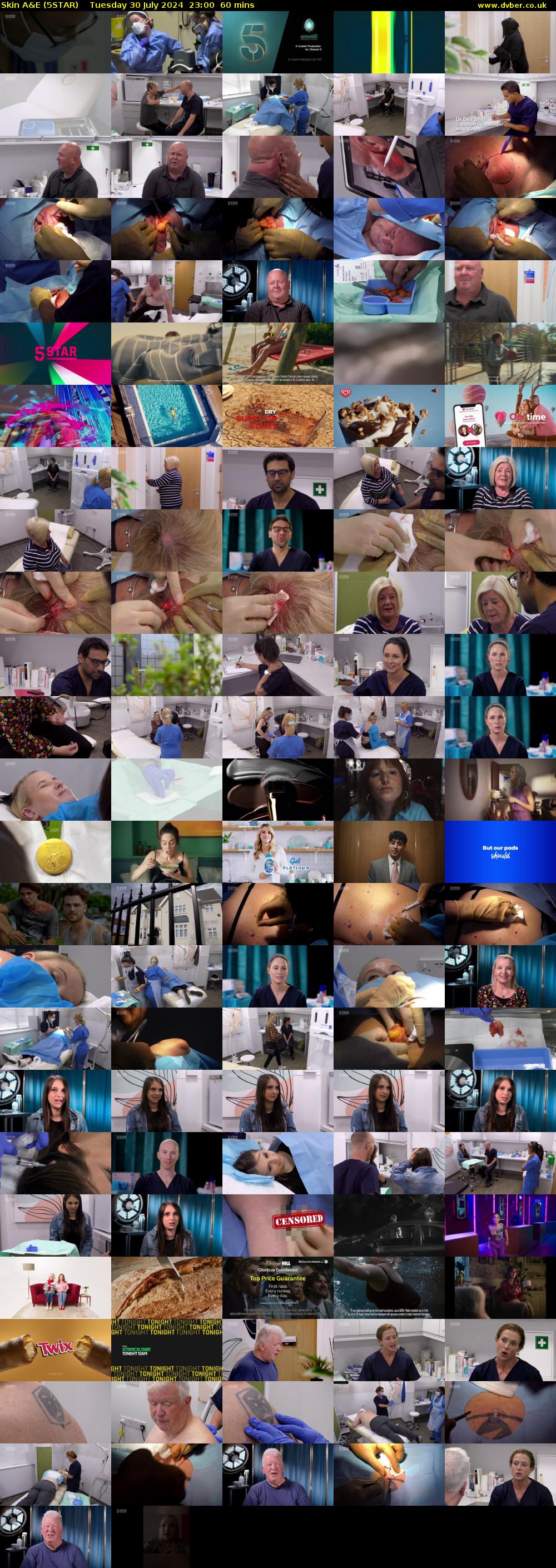 Skin A&E (5STAR) Tuesday 30 July 2024 23:00 - 00:00