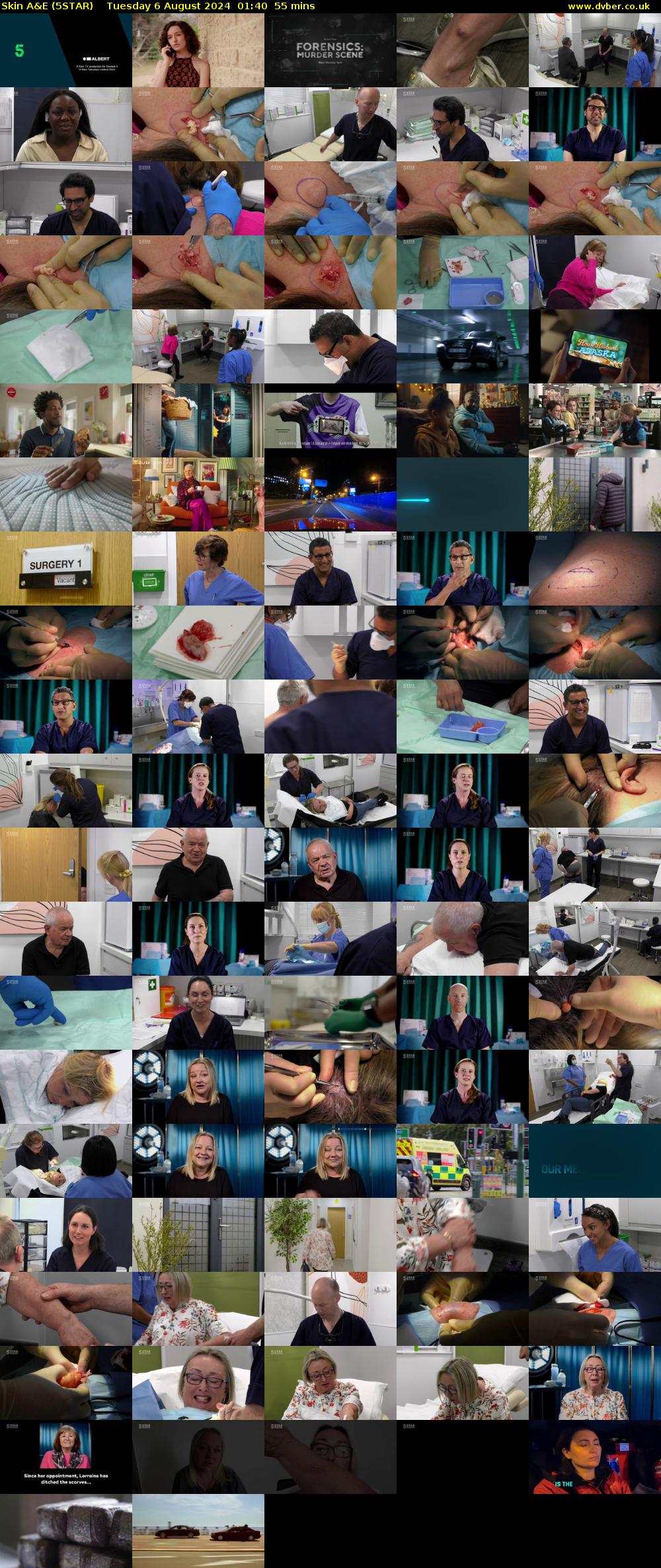 Skin A&E (5STAR) Tuesday 6 August 2024 01:40 - 02:35
