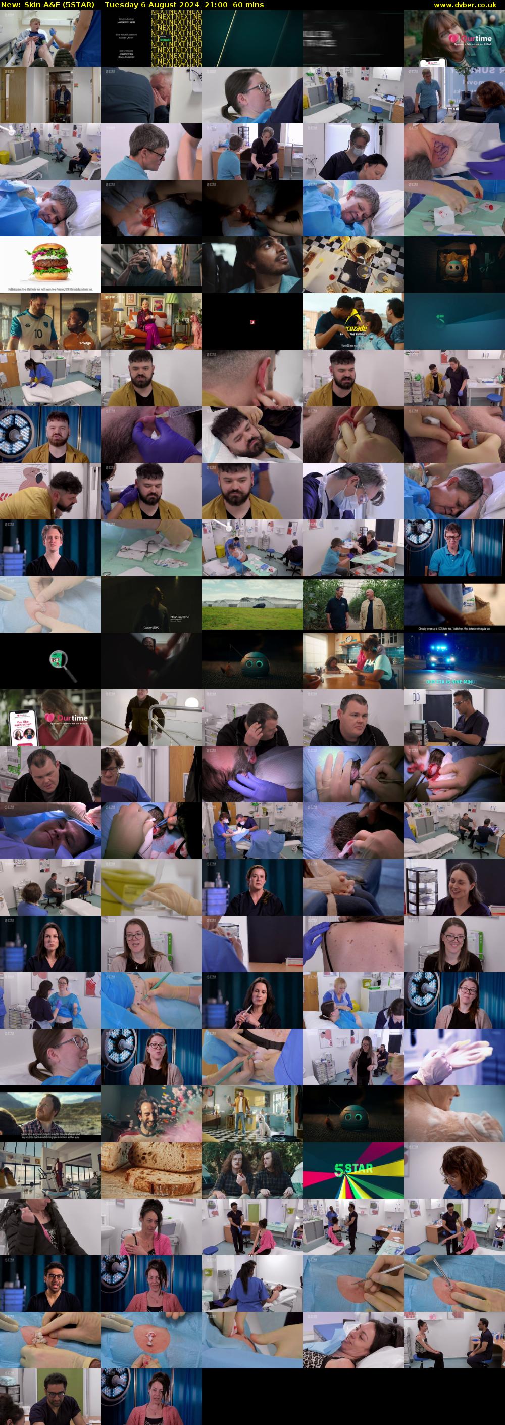 Skin A&E (5STAR) Tuesday 6 August 2024 21:00 - 22:00