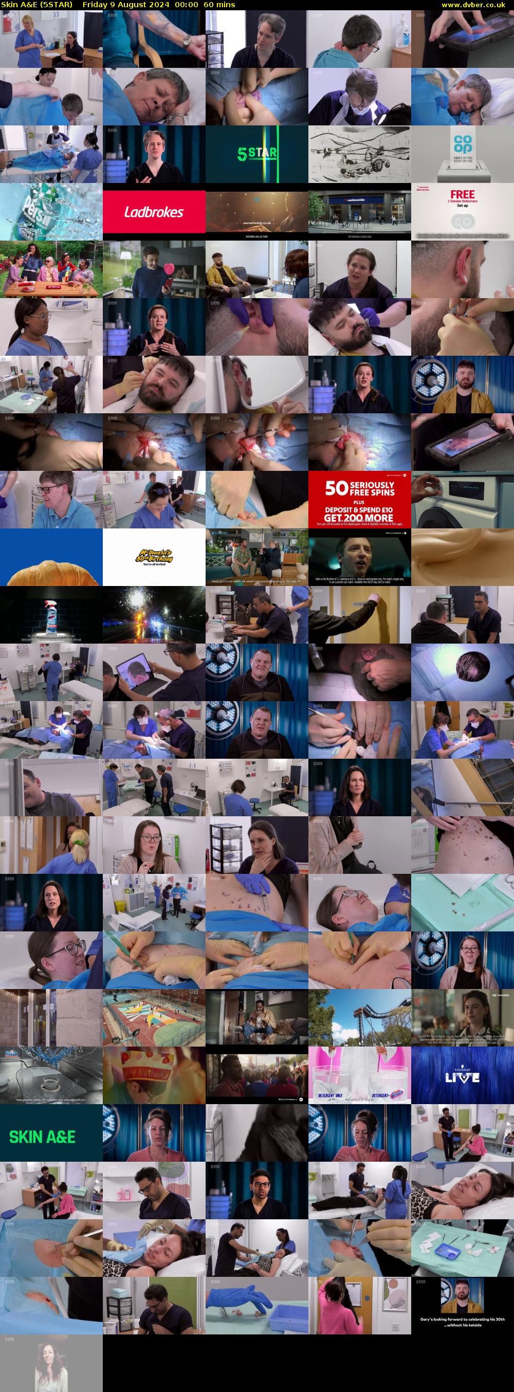 Skin A&E (5STAR) Friday 9 August 2024 00:00 - 01:00