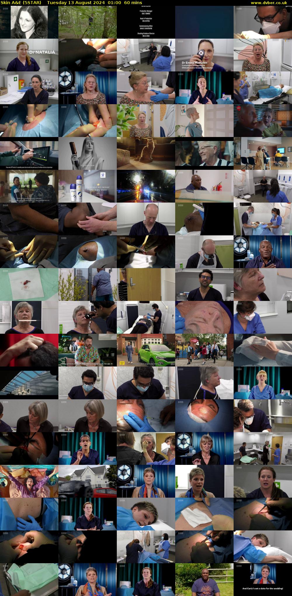 Skin A&E (5STAR) Tuesday 13 August 2024 01:00 - 02:00