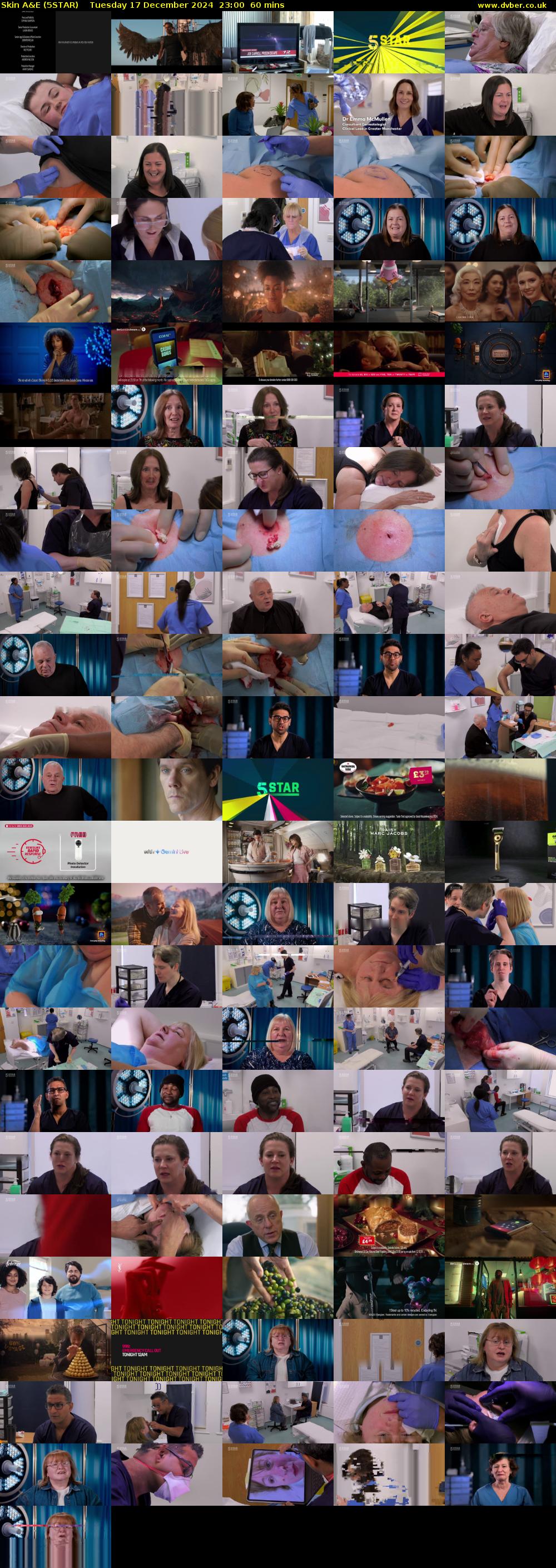 Skin A&E (5STAR) Tuesday 17 December 2024 23:00 - 00:00