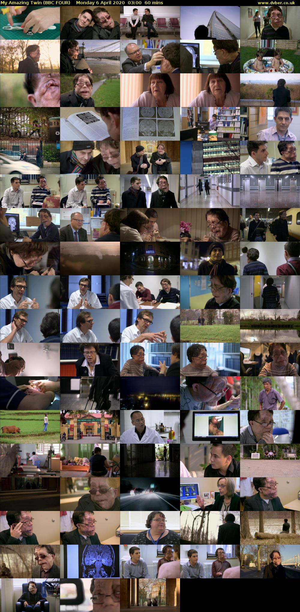 My Amazing Twin (BBC FOUR) Monday 6 April 2020 03:00 - 04:00
