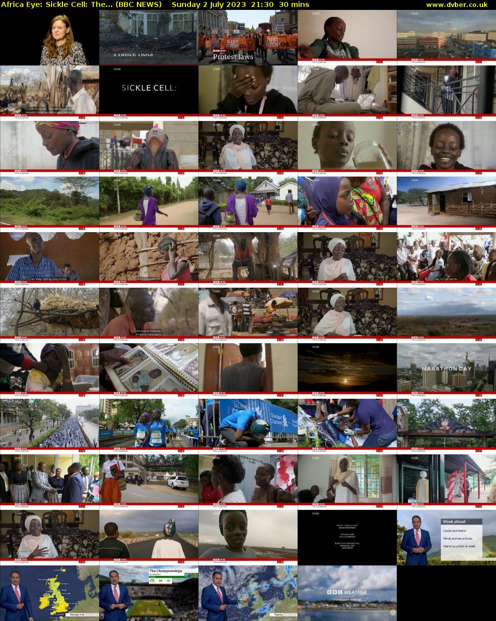 Africa Eye: Sickle Cell: The... (BBC NEWS) Sunday 2 July 2023 21:30 - 22:00