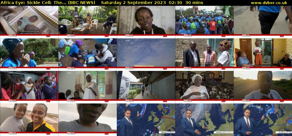 Africa Eye: Sickle Cell: The... (BBC NEWS) Saturday 2 September 2023 02:30 - 03:00