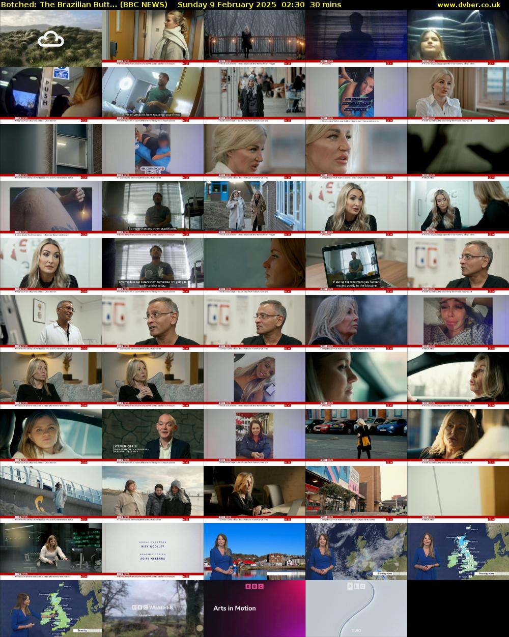Botched: The Brazilian Butt... (BBC NEWS) Sunday 9 February 2025 02:30 - 03:00