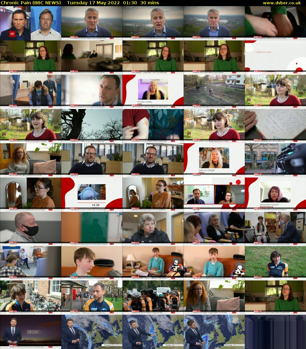 Chronic Pain (BBC NEWS) Tuesday 17 May 2022 01:30 - 02:00
