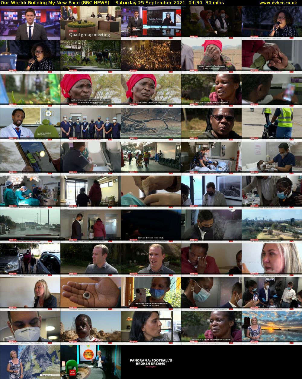 Our World: Building My New Face (BBC NEWS) Saturday 25 September 2021 04:30 - 05:00