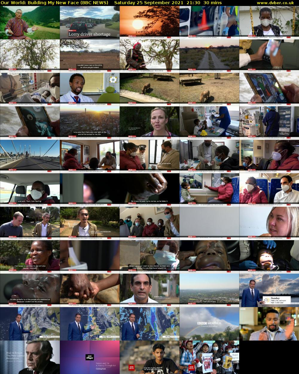 Our World: Building My New Face (BBC NEWS) Saturday 25 September 2021 21:30 - 22:00