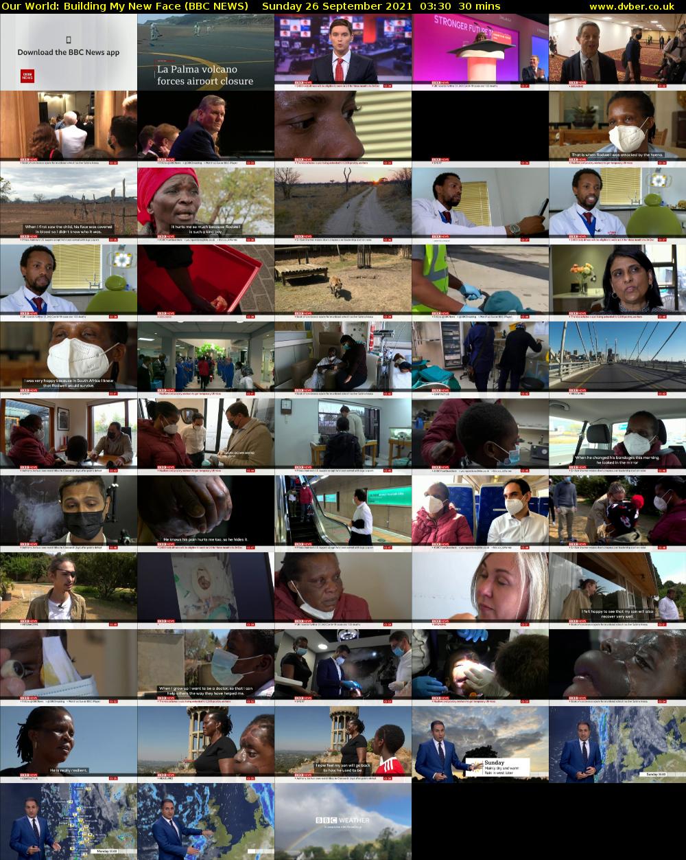 Our World: Building My New Face (BBC NEWS) Sunday 26 September 2021 03:30 - 04:00
