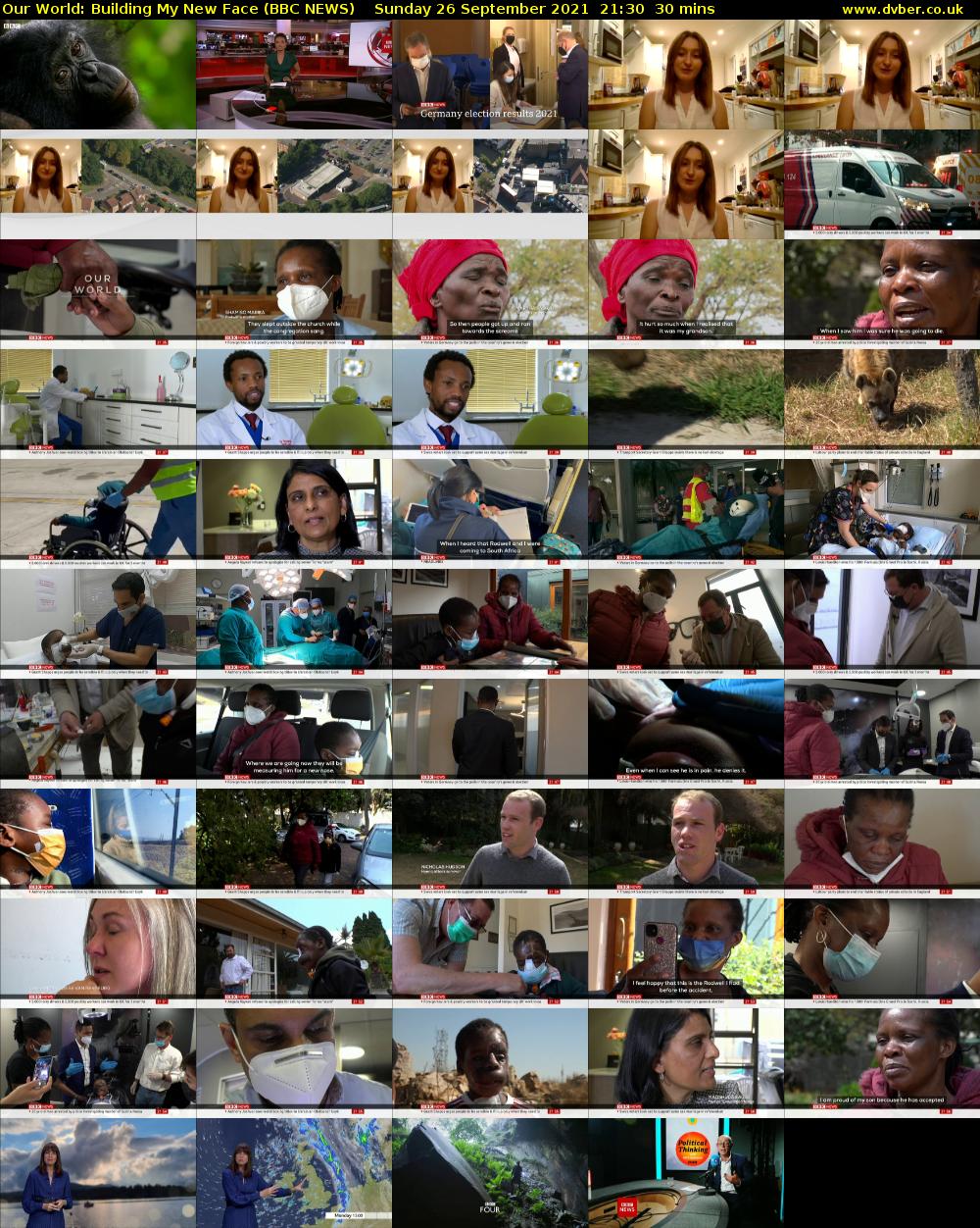 Our World: Building My New Face (BBC NEWS) Sunday 26 September 2021 21:30 - 22:00