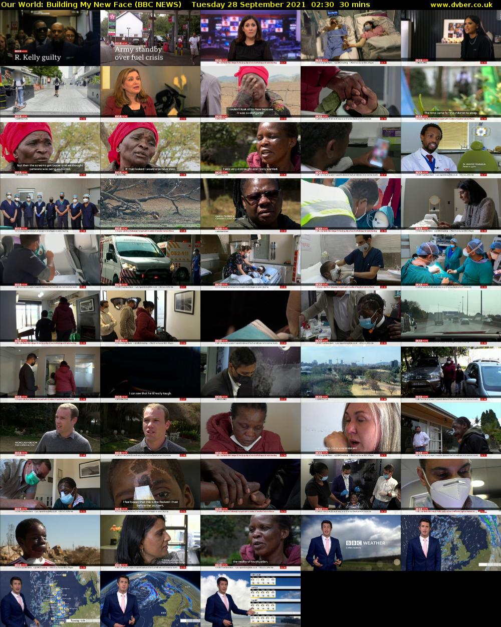 Our World: Building My New Face (BBC NEWS) Tuesday 28 September 2021 02:30 - 03:00