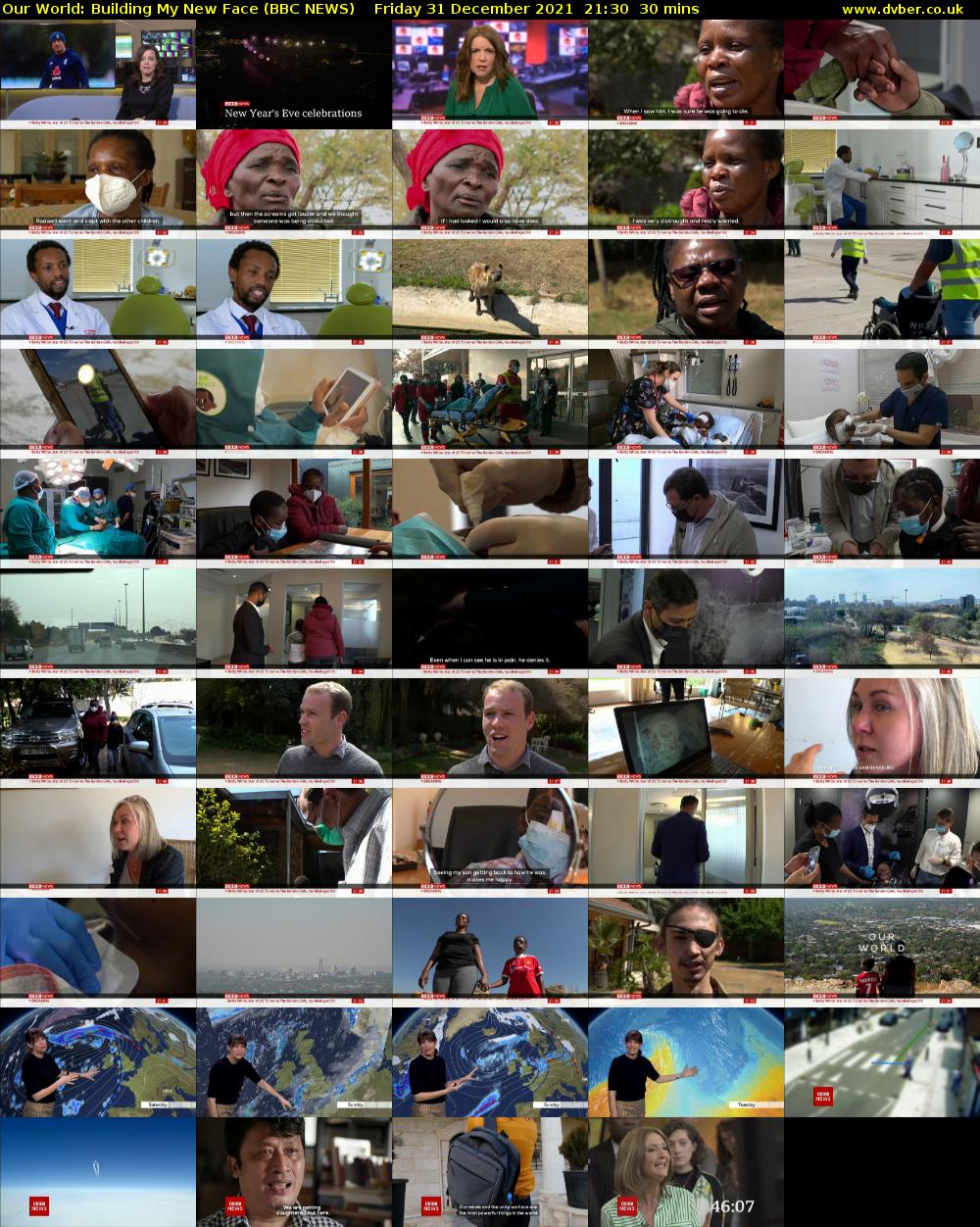 Our World: Building My New Face (BBC NEWS) Friday 31 December 2021 21:30 - 22:00