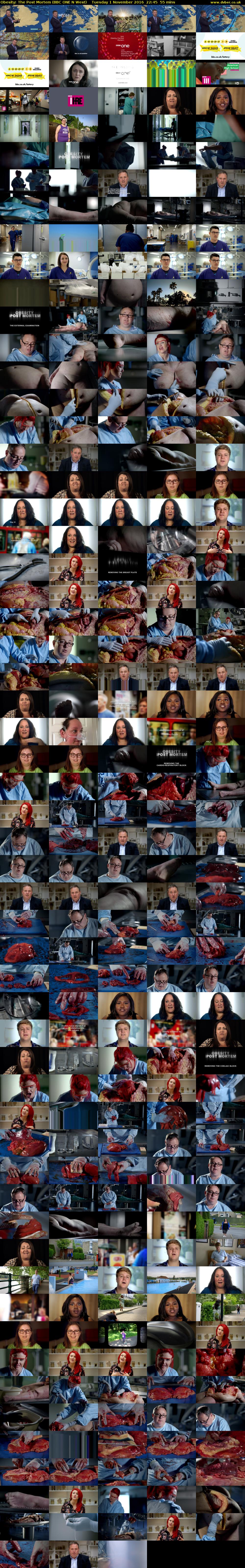 Obesity: The Post Mortem (BBC ONE N West) Tuesday 1 November 2016 22:45 - 23:40