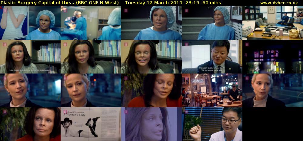 Plastic Surgery Capital of the... (BBC ONE N West) Tuesday 12 March 2019 23:15 - 00:15