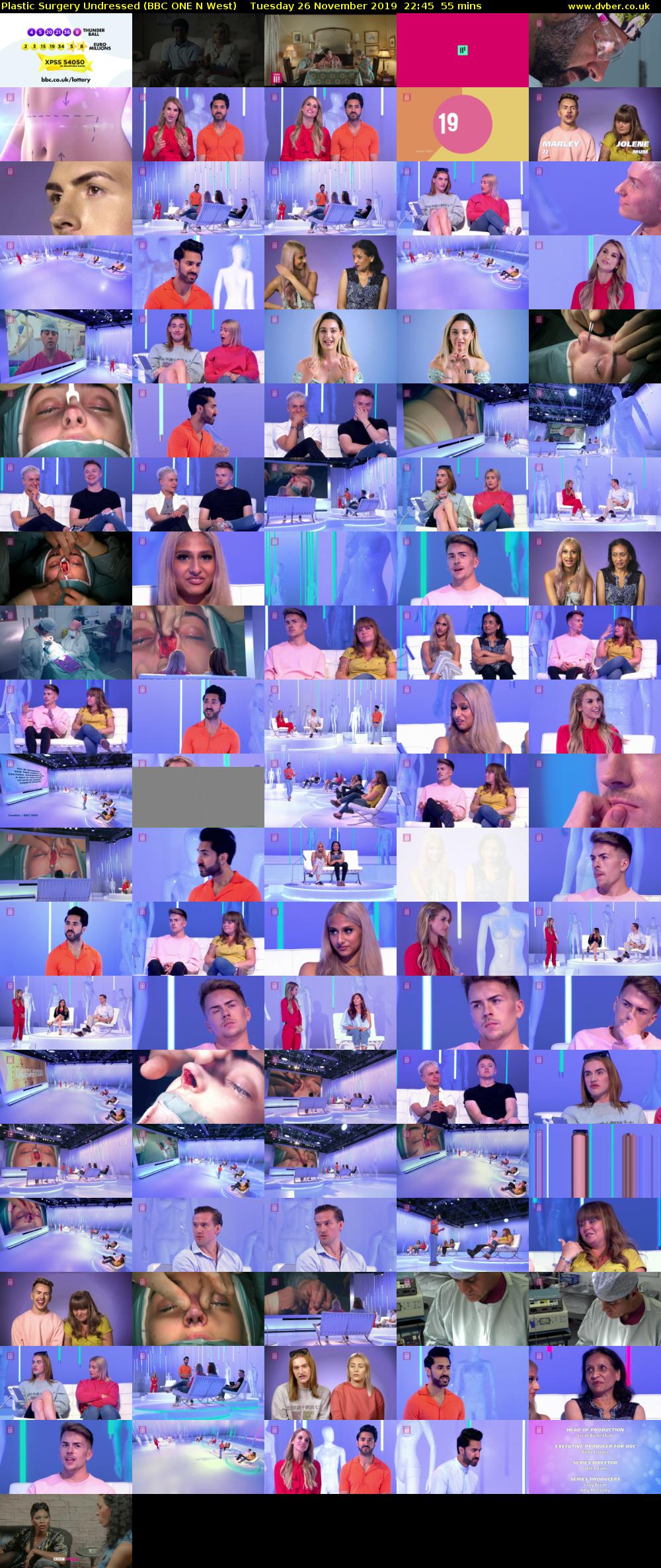 Plastic Surgery Undressed (BBC ONE N West) Tuesday 26 November 2019 22:45 - 23:40
