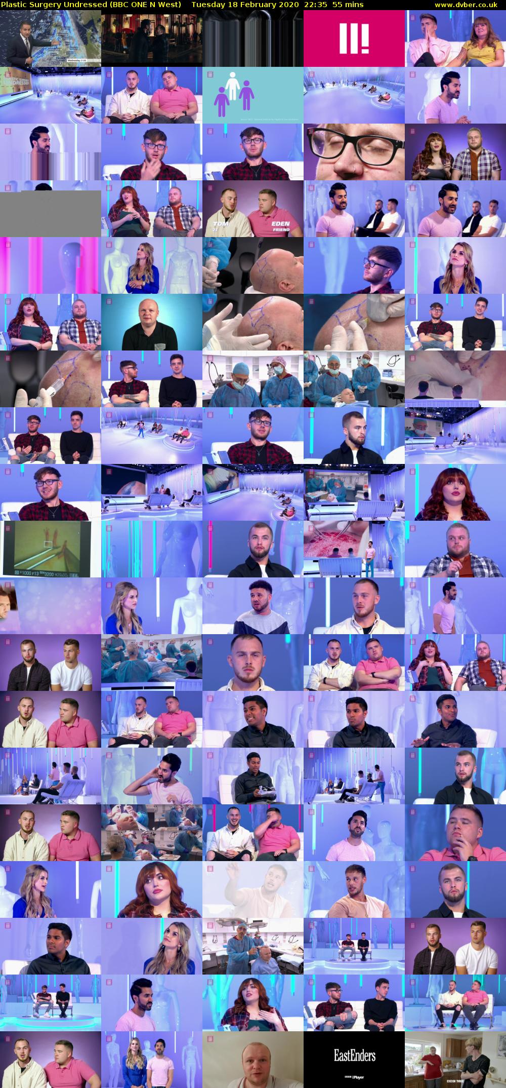 Plastic Surgery Undressed (BBC ONE N West) Tuesday 18 February 2020 22:35 - 23:30