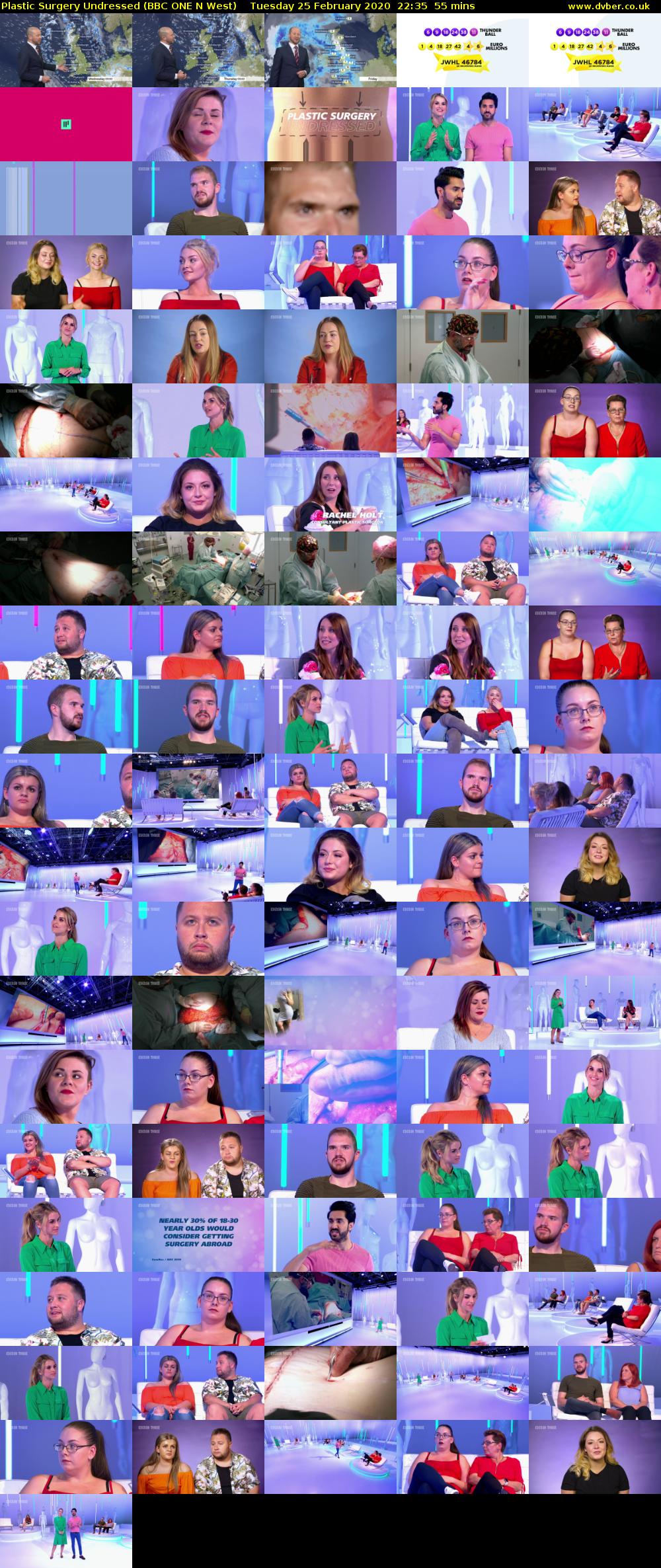 Plastic Surgery Undressed (BBC ONE N West) Tuesday 25 February 2020 22:35 - 23:30