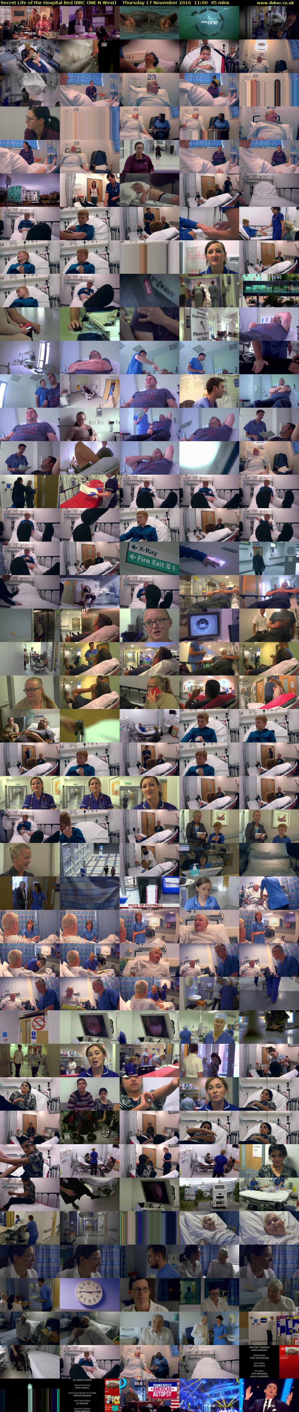 Secret Life of the Hospital Bed (BBC ONE N West) Thursday 17 November 2016 11:00 - 11:45