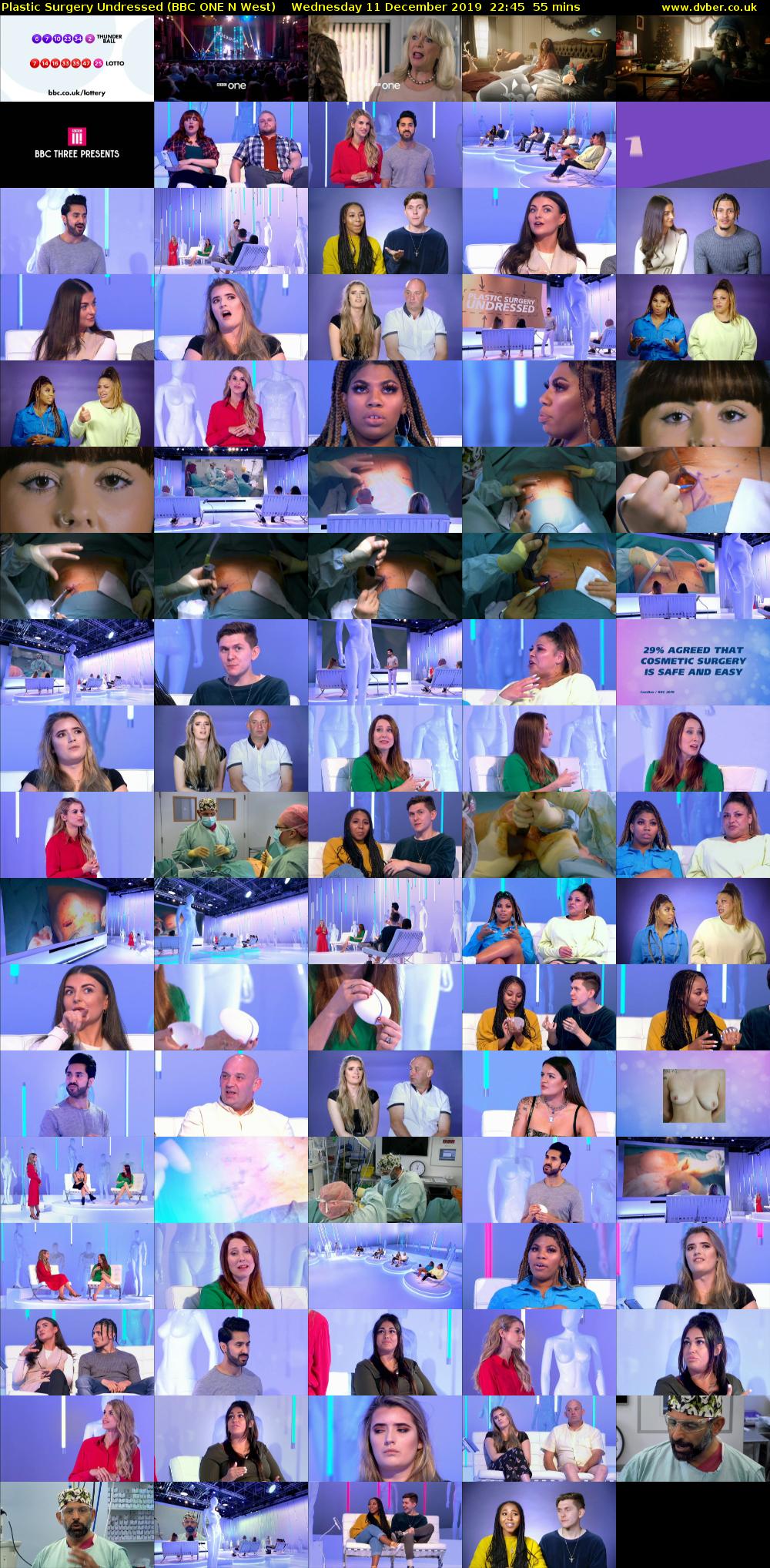 Plastic Surgery Undressed (BBC ONE N West) Wednesday 11 December 2019 22:45 - 23:40