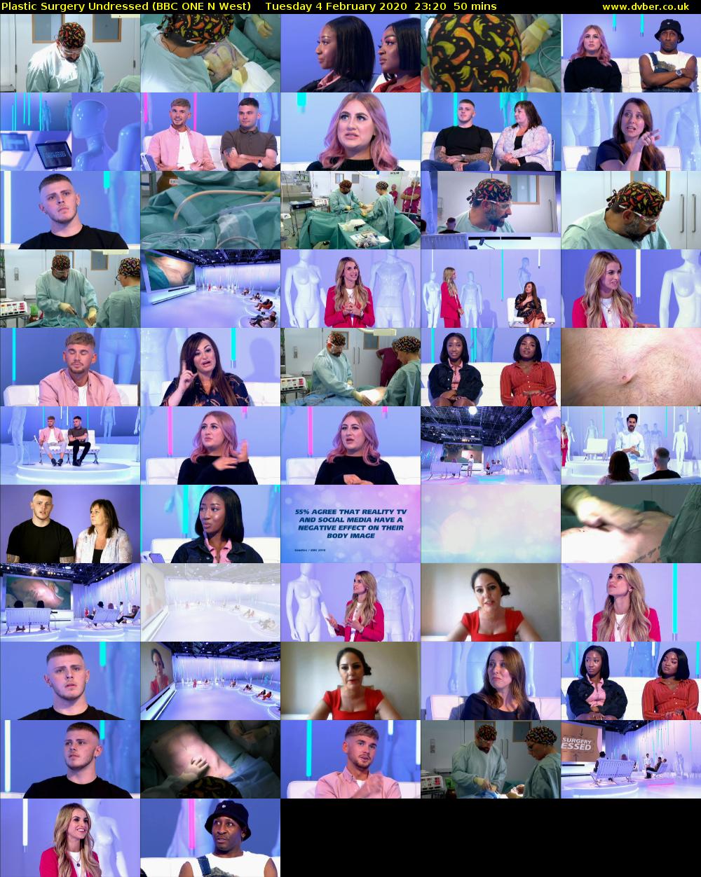 Plastic Surgery Undressed (BBC ONE N West) Tuesday 4 February 2020 23:20 - 00:10