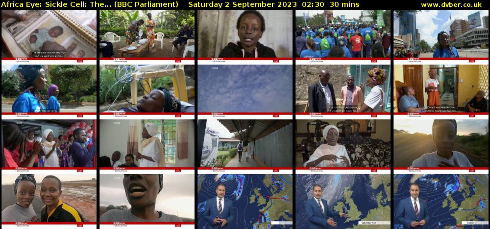 Africa Eye: Sickle Cell: The... (BBC Parliament) Saturday 2 September 2023 02:30 - 03:00