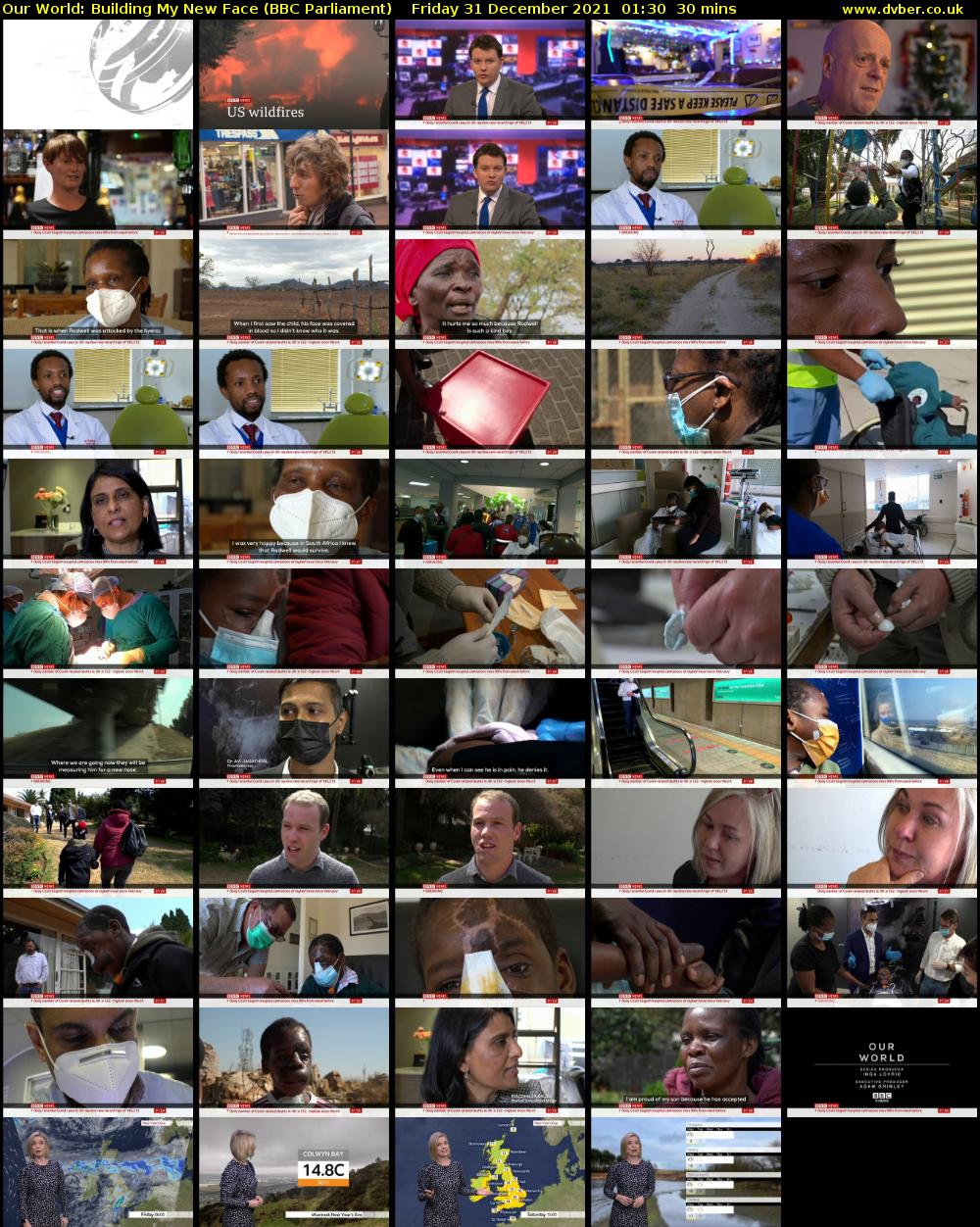 Our World: Building My New Face (BBC Parliament) Friday 31 December 2021 01:30 - 02:00