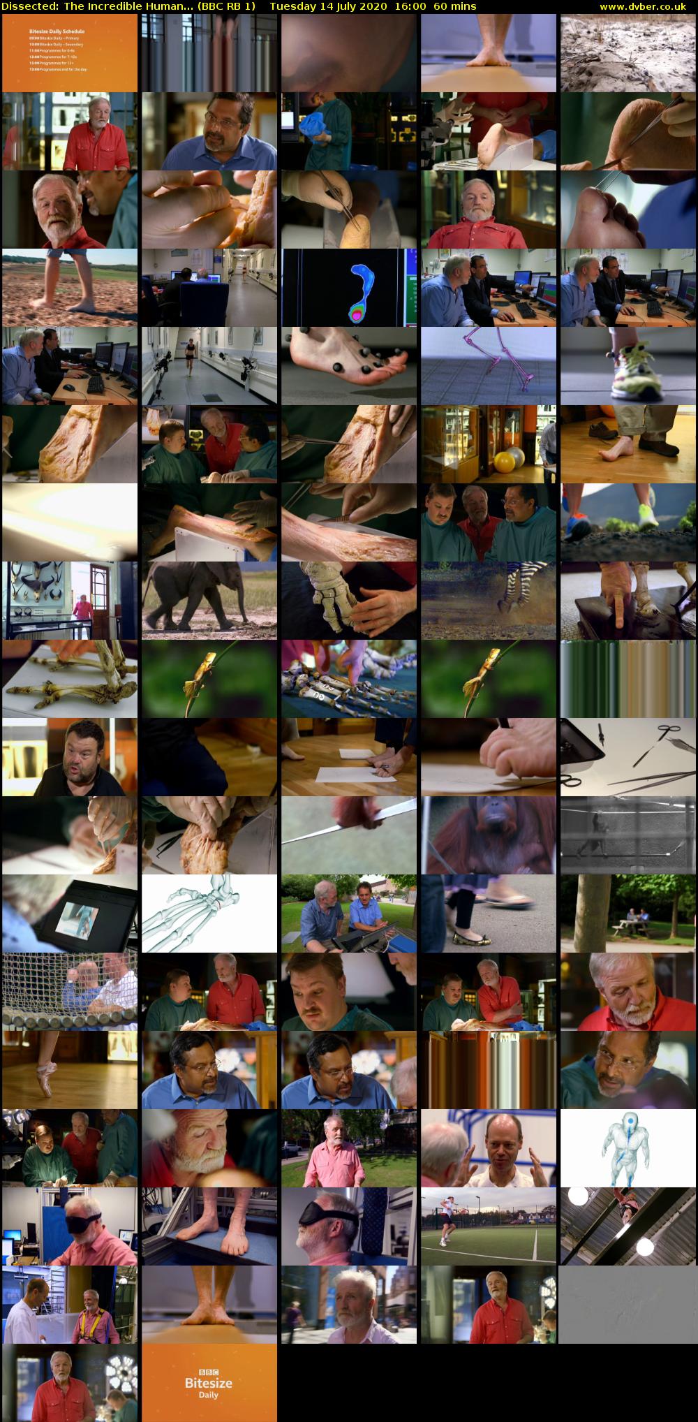 Dissected: The Incredible Human... (BBC RB 1) Tuesday 14 July 2020 16:00 - 17:00