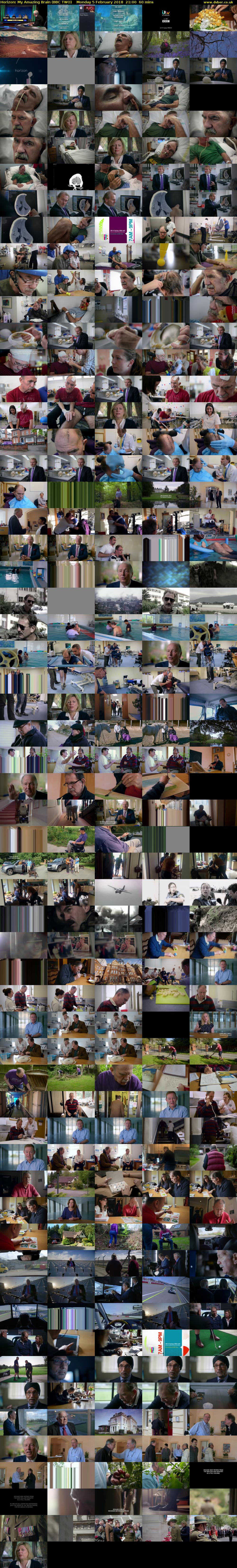 Horizon: My Amazing Brain (BBC TWO) Monday 5 February 2018 21:00 - 22:00