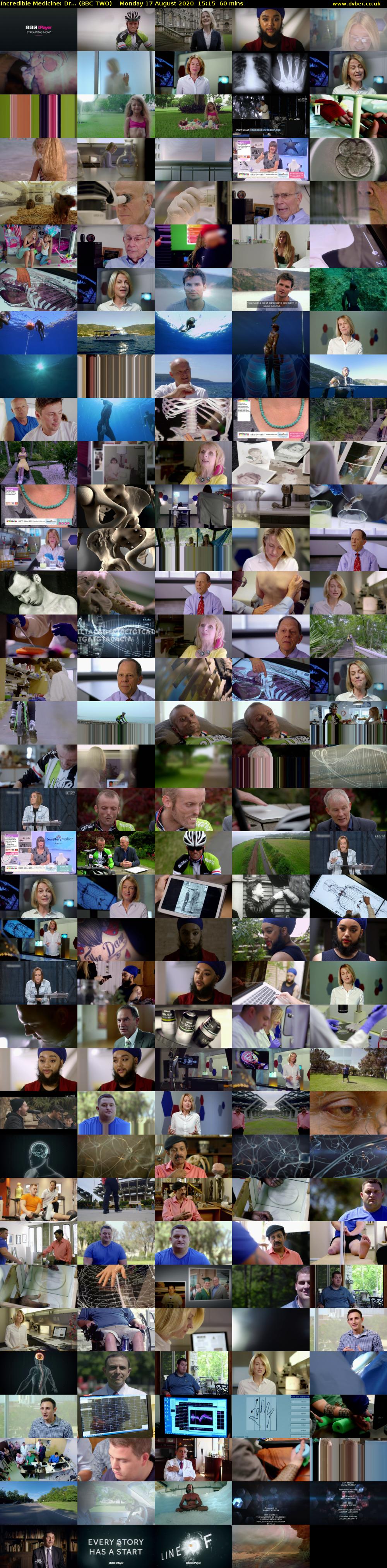 Incredible Medicine: Dr... (BBC TWO) Monday 17 August 2020 15:15 - 16:15