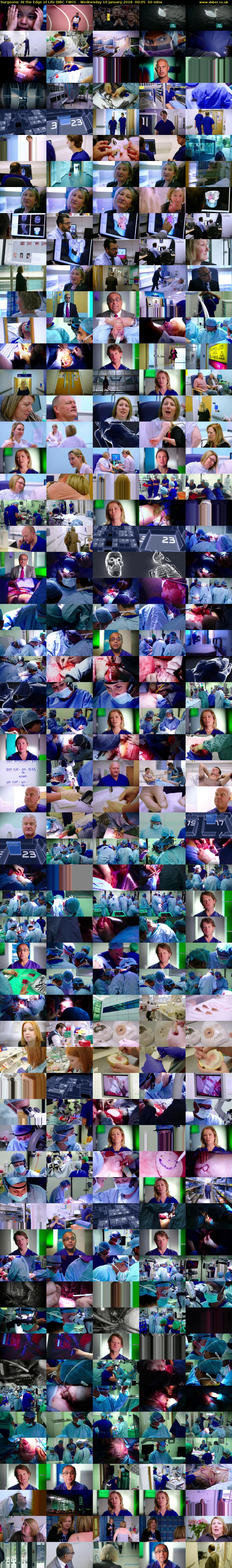 Surgeons: At the Edge of Life (BBC TWO) Wednesday 10 January 2018 00:05 - 01:05