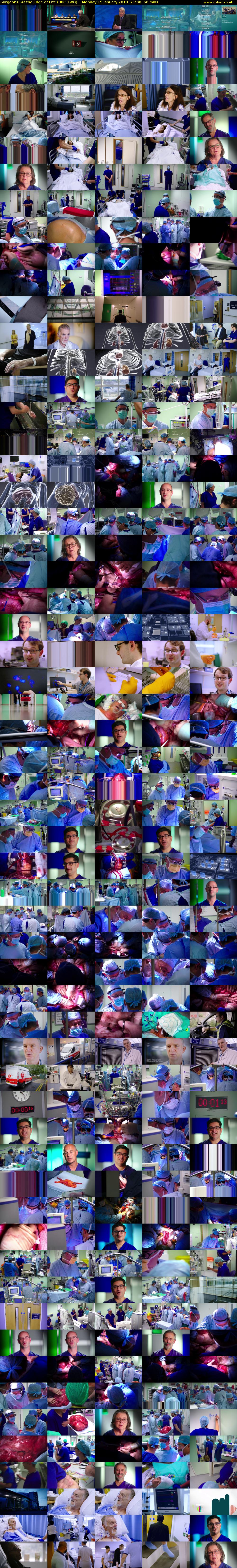 Surgeons: At the Edge of Life (BBC TWO) Monday 15 January 2018 21:00 - 22:00