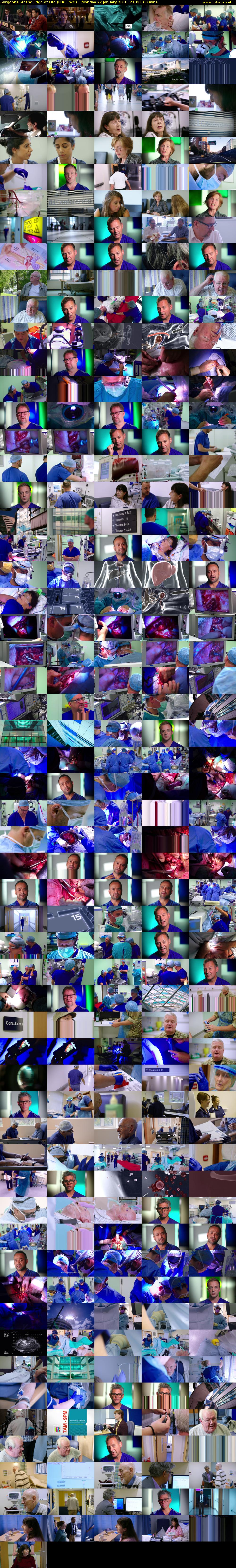 Surgeons: At the Edge of Life (BBC TWO) Monday 22 January 2018 21:00 - 22:00