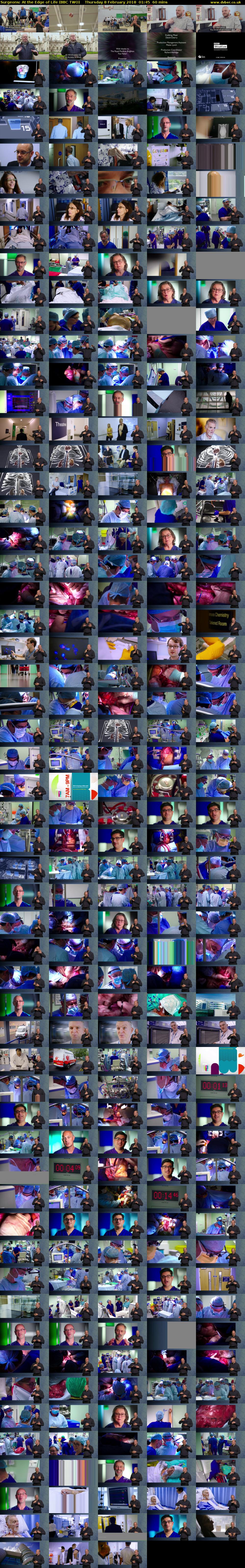 Surgeons: At the Edge of Life (BBC TWO) Thursday 8 February 2018 01:45 - 02:45