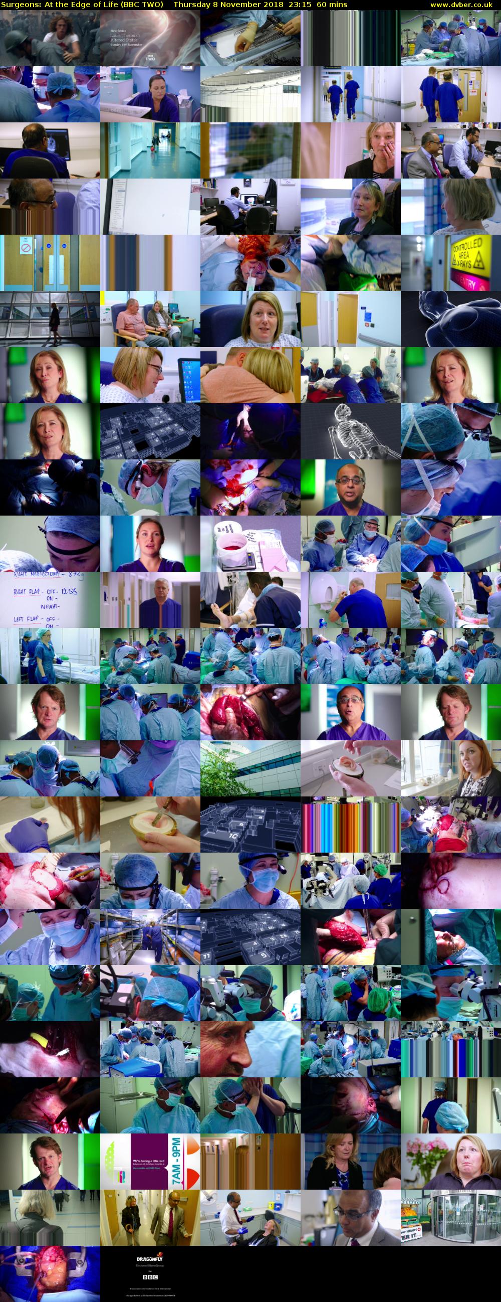 Surgeons: At the Edge of Life (BBC TWO) Thursday 8 November 2018 23:15 - 00:15