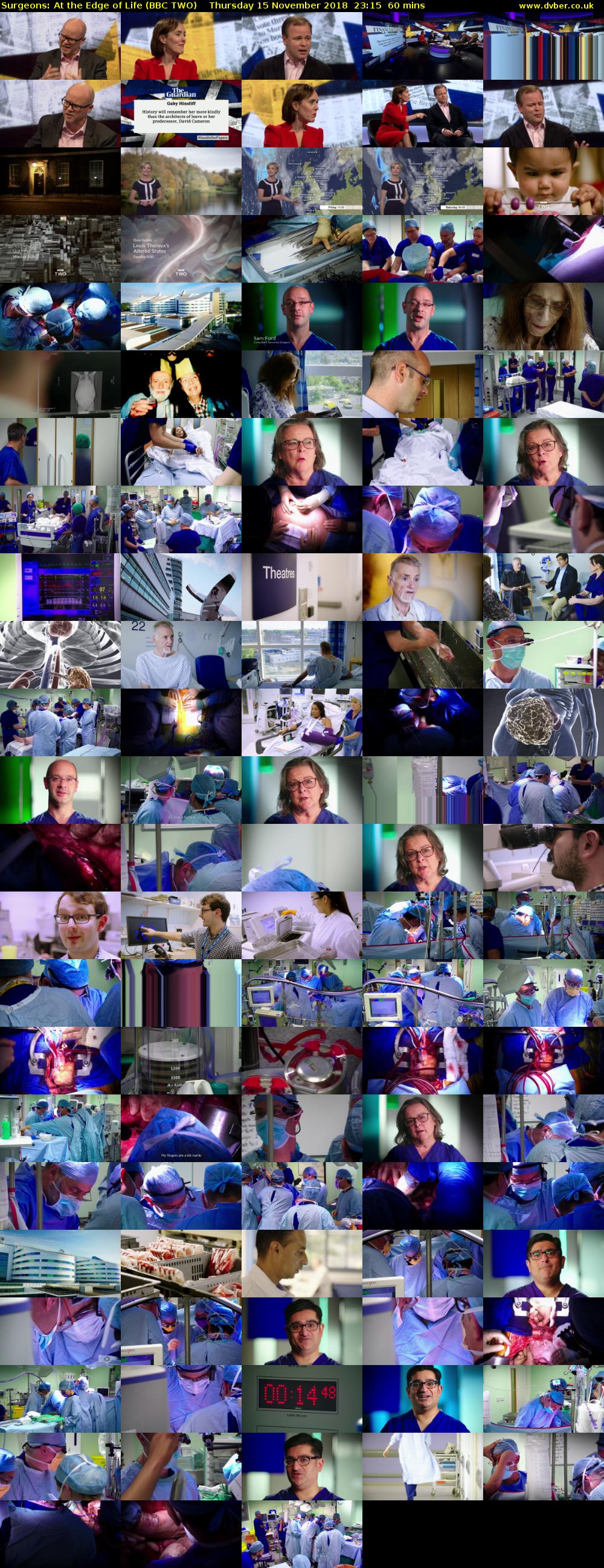 Surgeons: At the Edge of Life (BBC TWO) Thursday 15 November 2018 23:15 - 00:15