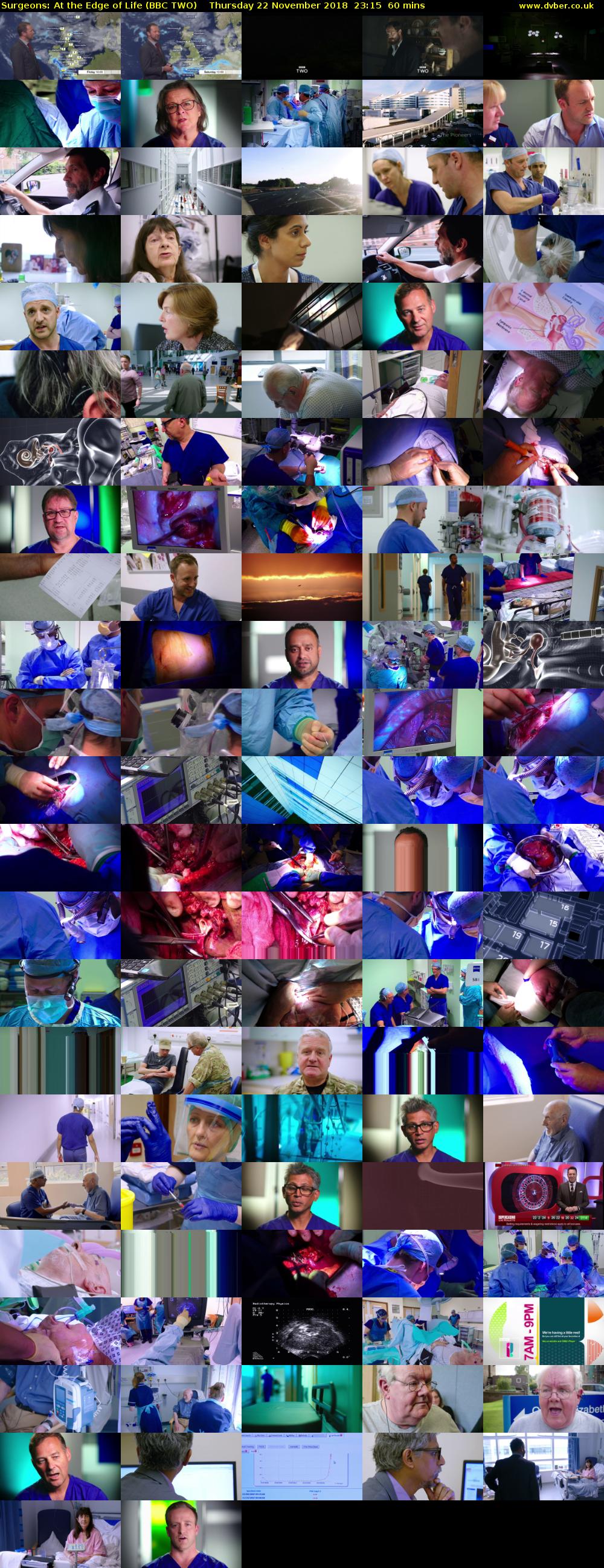 Surgeons: At the Edge of Life (BBC TWO) Thursday 22 November 2018 23:15 - 00:15