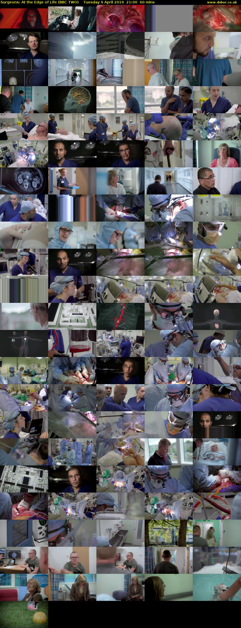 Surgeons: At the Edge of Life (BBC TWO) Tuesday 9 April 2019 21:00 - 22:00