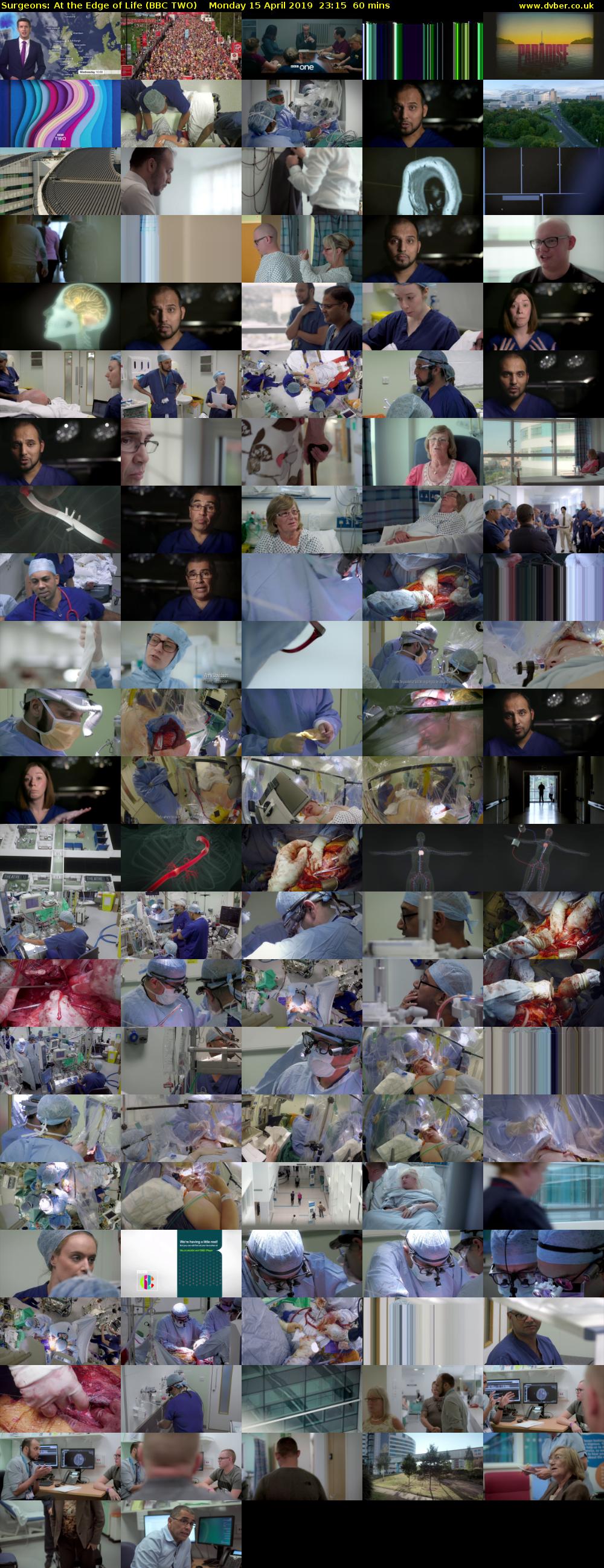 Surgeons: At the Edge of Life (BBC TWO) Monday 15 April 2019 23:15 - 00:15