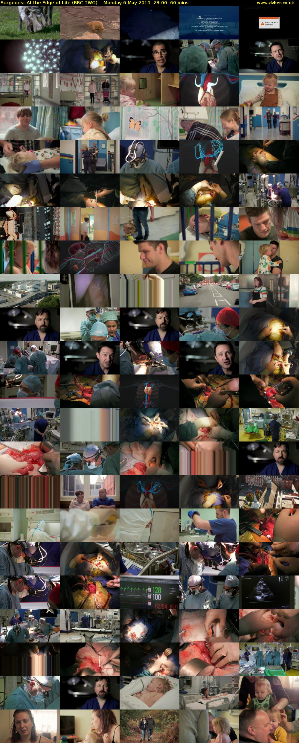 Surgeons: At the Edge of Life (BBC TWO) Monday 6 May 2019 23:00 - 00:00