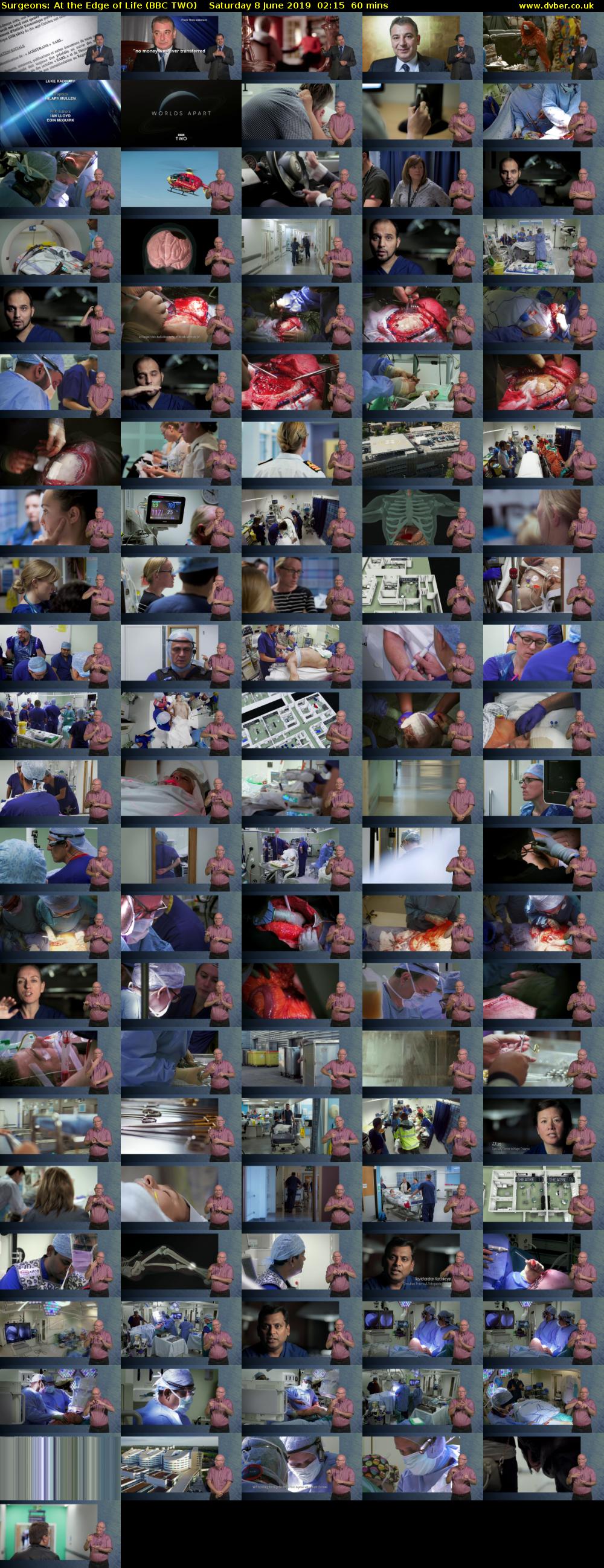 Surgeons: At the Edge of Life (BBC TWO) Saturday 8 June 2019 02:15 - 03:15